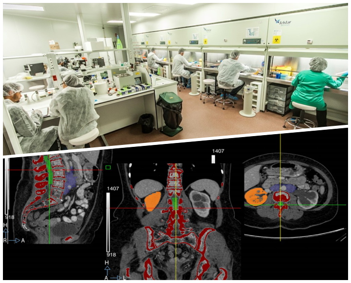 Ingenieria Biomedica